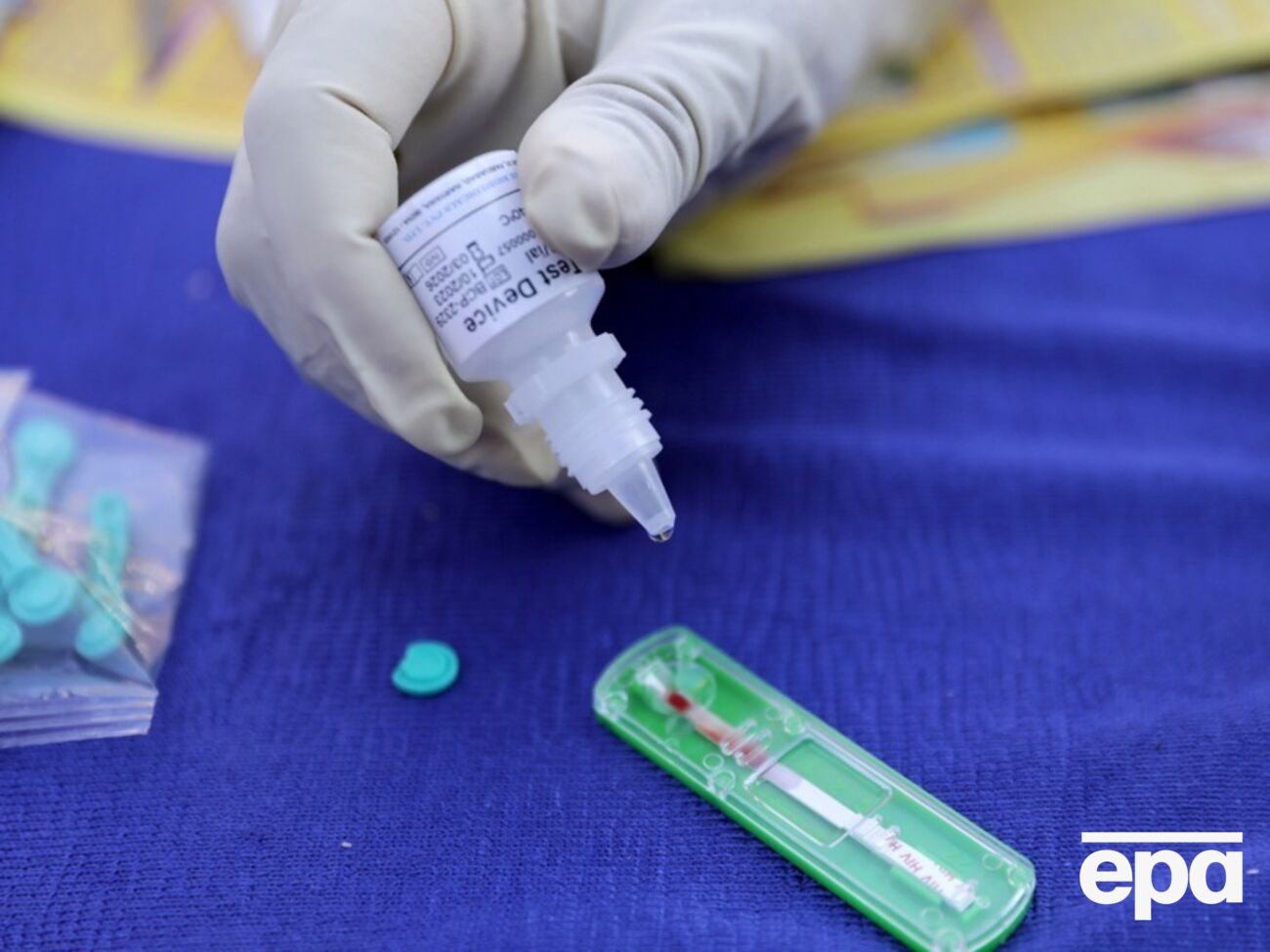 В ООН рассказали о результатах борьбы со СПИД