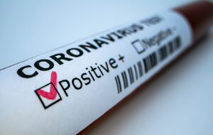 По данным государственного учреждения "Киевский городской центр контроля и профилактики болезней", всего в июле зарегистрировали 900 случаев заболеваний COVID-19