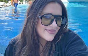 Могилевська назвала форму носа своєю фішкою