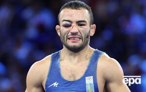 Під час боїв 7 серпня в Насібова було помітно серйозну гематому на правому оці