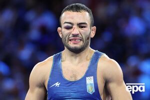 Під час боїв 7 серпня в Насібова було помітно серйозну гематому на правому оці