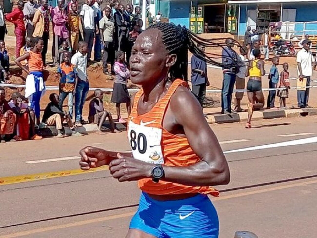 Напавший получил серьезные ожоги дыхательных путей и сепсис