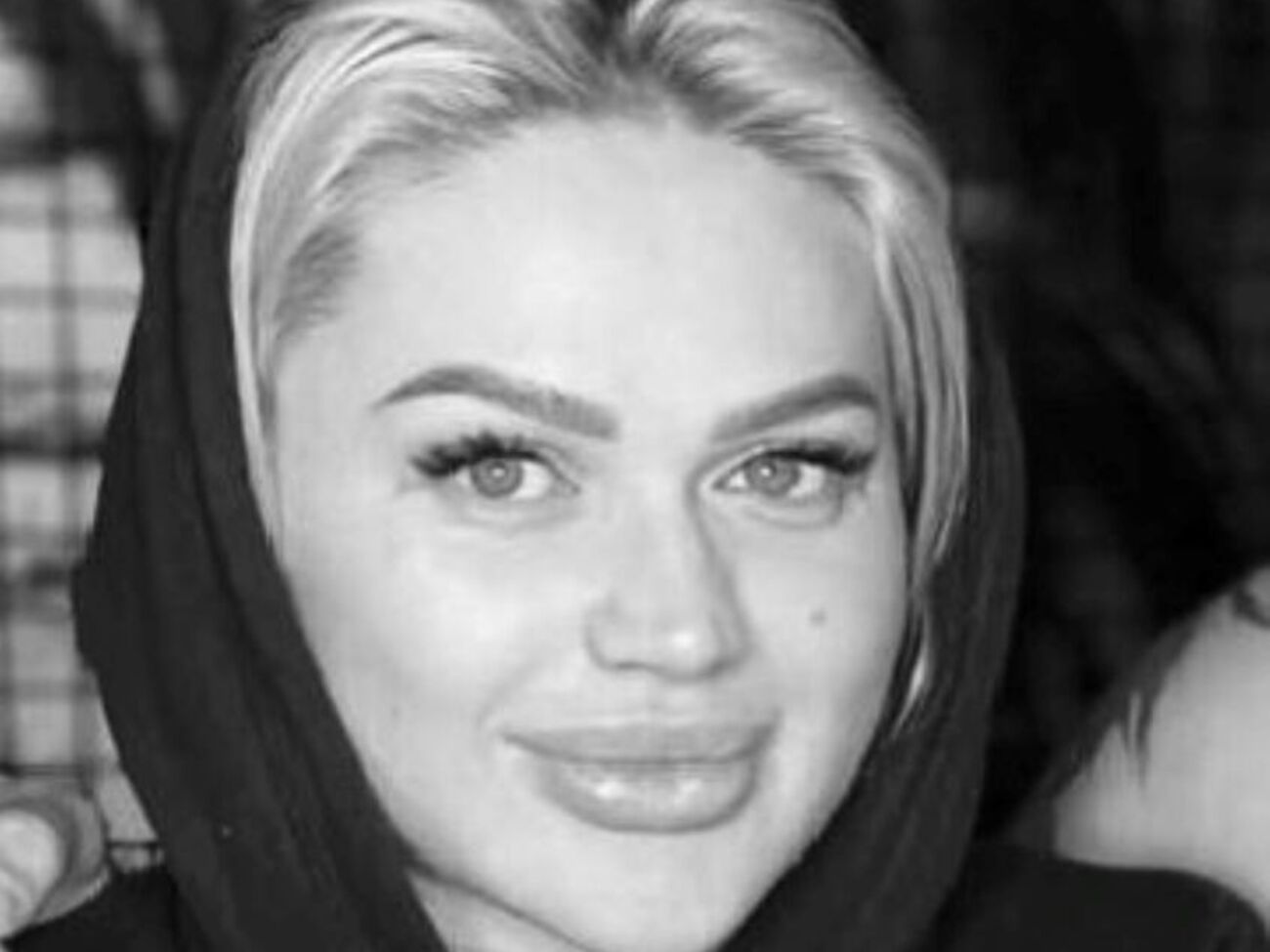 Из-за полученных травм во время аварии Билевцов был с перевязанной рукой