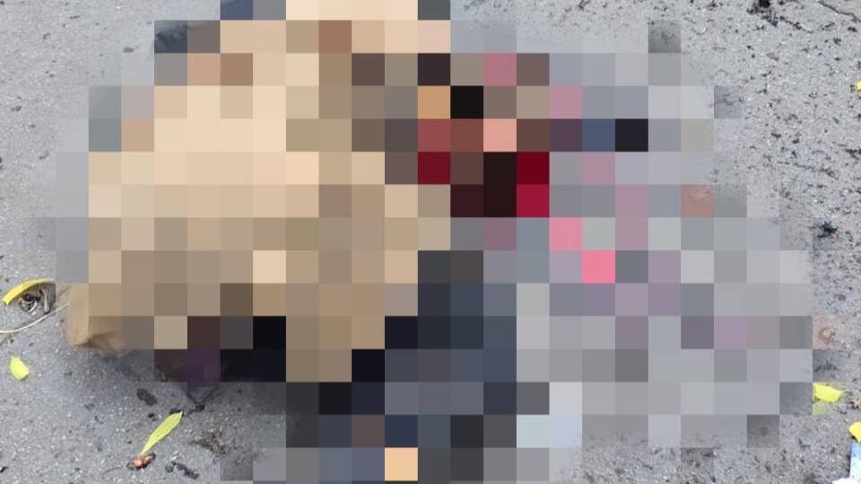 В момент атаки женщина находилась на улице, отметила прокуратура