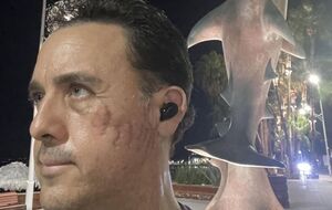 Хойос считает, что акула пощадила его