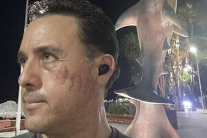 Хойос вважає, що акула пощадила його