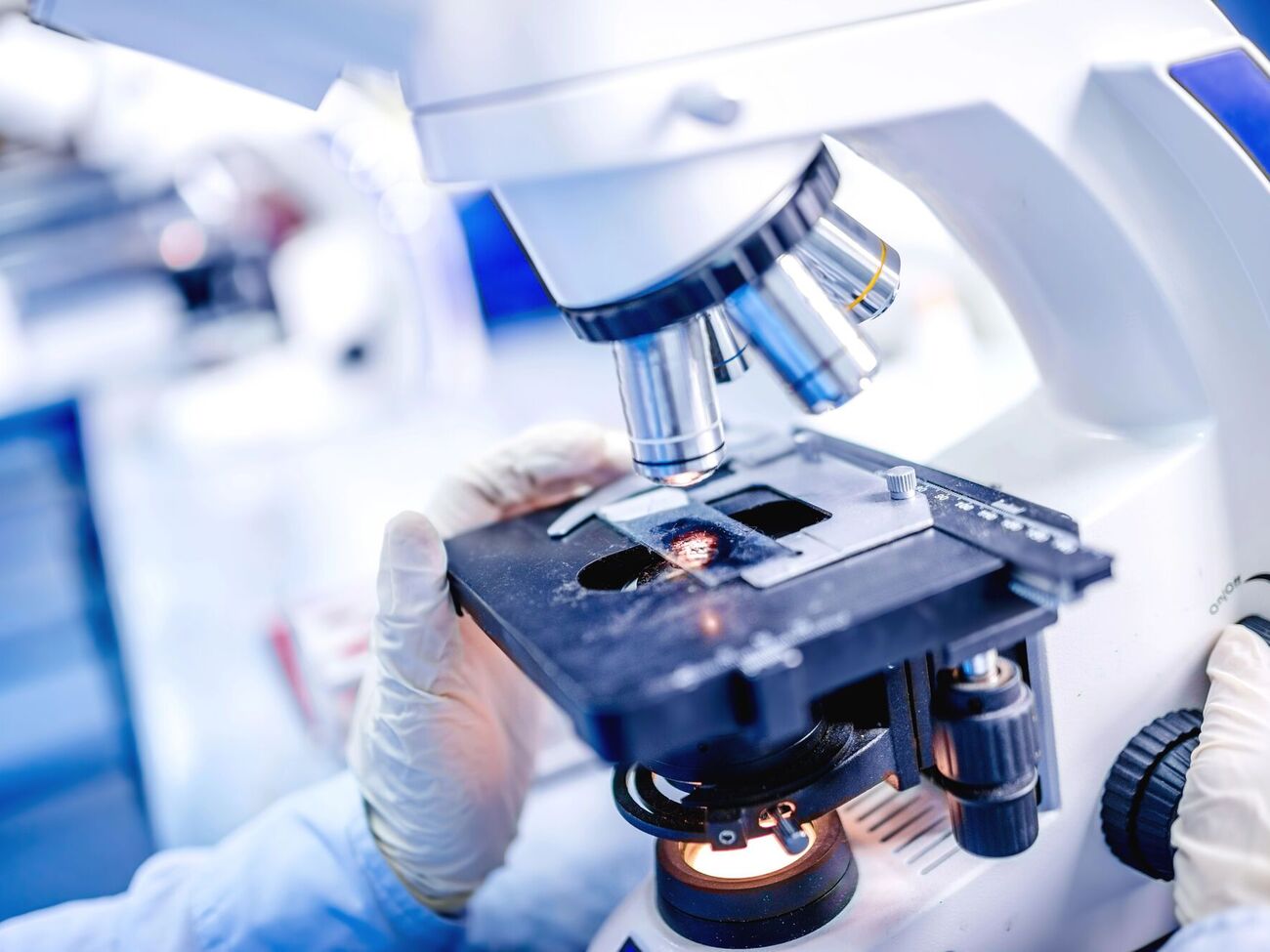 В Африке уже зафиксировано более 7 тыс. смертей от холеры