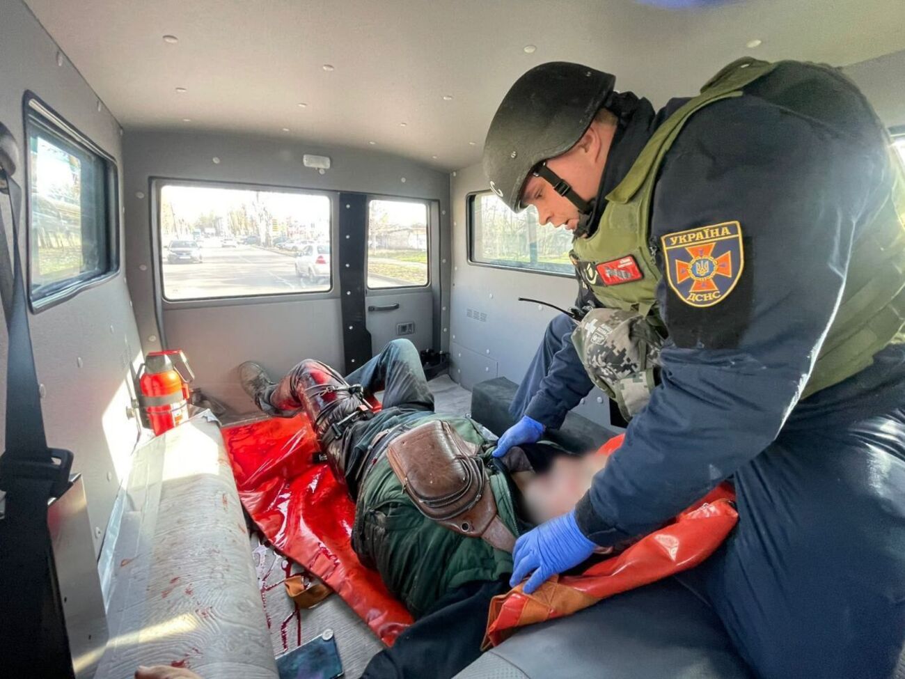 60-летнего раненого госпитализировали в тяжелом состоянии