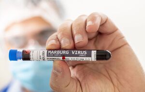 В Ефіопії вперше задокументували спалах вірусу Марбург