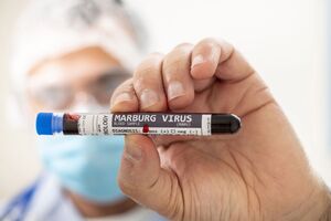 В Эфиопии впервые задокументировали вспышку вируса Марбург