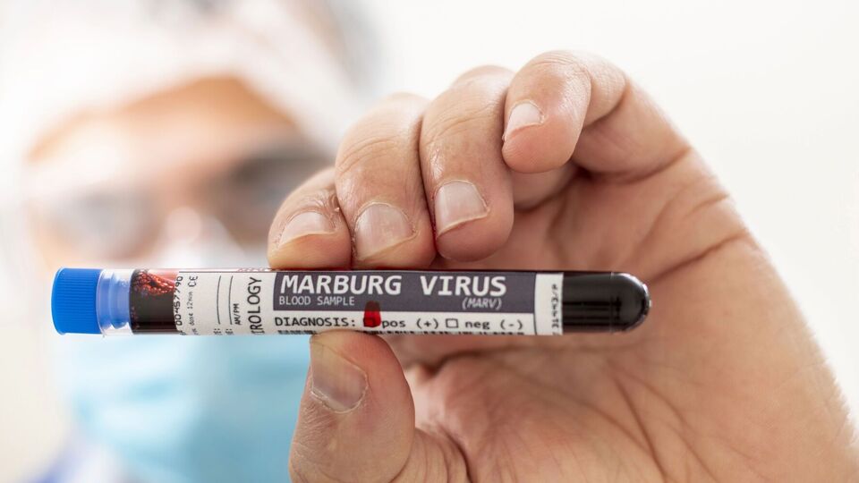 В Эфиопии впервые задокументировали вспышку вируса Марбург