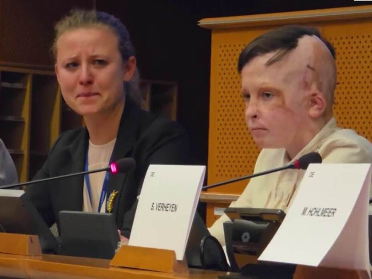 11-річний Роман Олексів розповів євродепутатам про удар росіян по Вінниці в липні 2022 року, унаслідок якого він втратив маму й дістав складні ушкодження