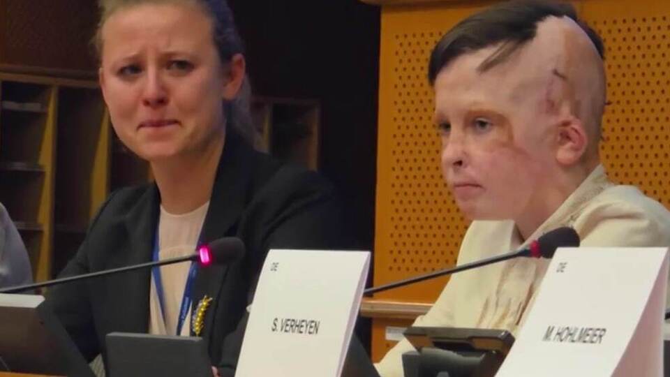 11-річний Роман Олексів розповів євродепутатам про удар росіян по Вінниці в липні 2022 року, унаслідок якого він втратив маму й дістав складні ушкодження