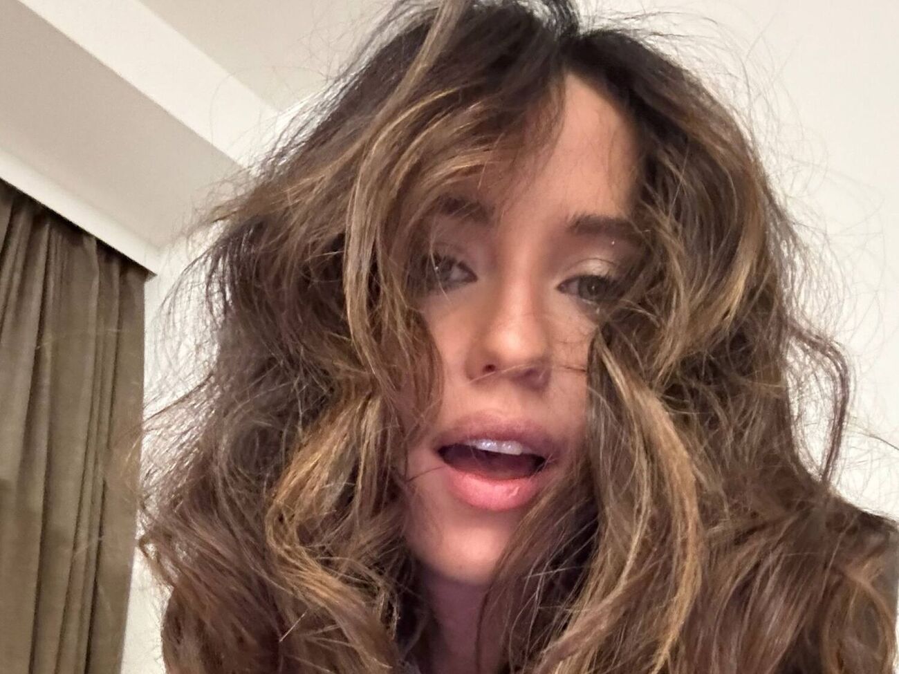 Дорофєєва: Ці синці говорять про те, що ходжу на танці