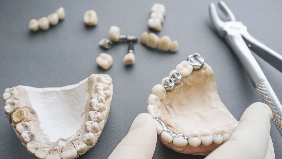 Зубы знаменитостей пользуются большим спросом