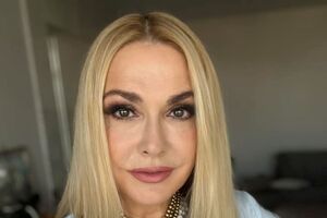 Сумська: Жодної пластичної операції не робила