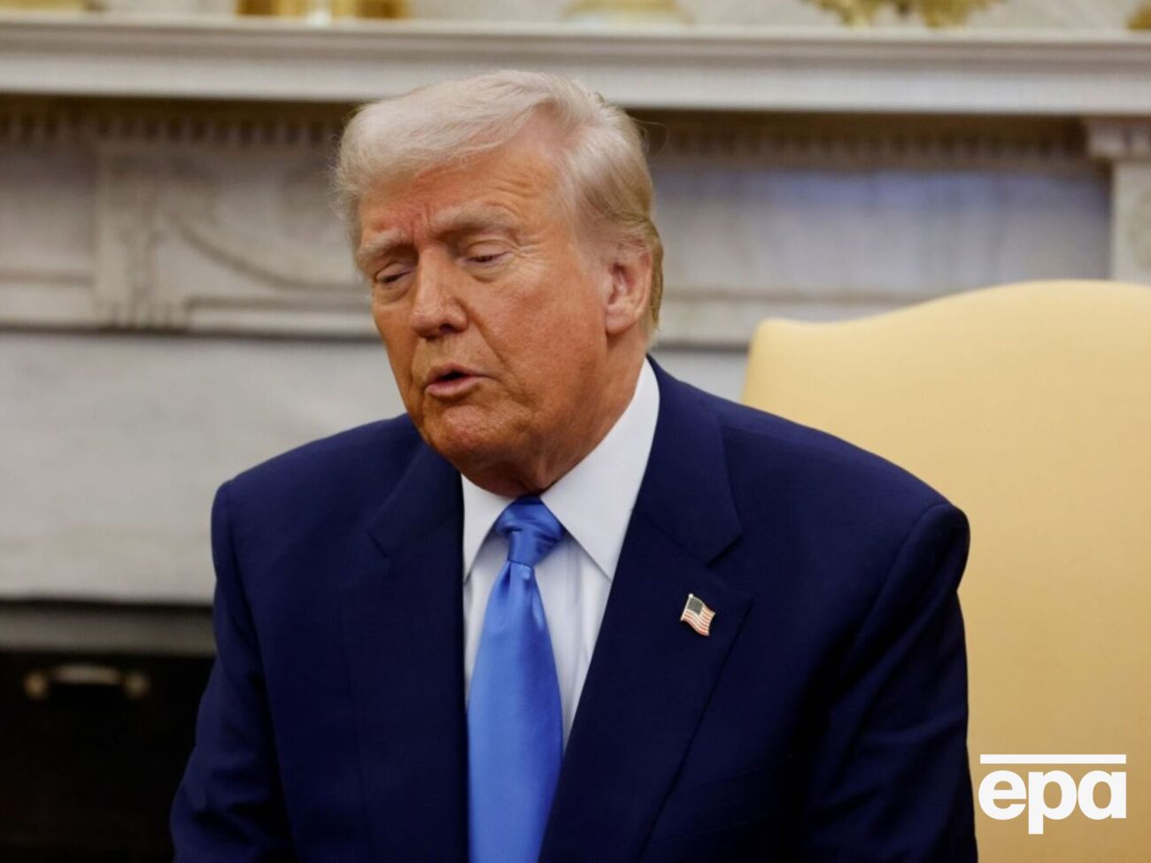 Ранее журналисты также замечали синяки на правой руке Трампа