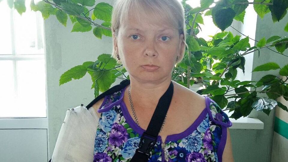 Оксана розповіла про відновлення після поранення