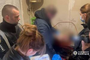 Попередньо встановили, що в січні дитина дістала опіки кількох ділянок тіла через недогляд матері