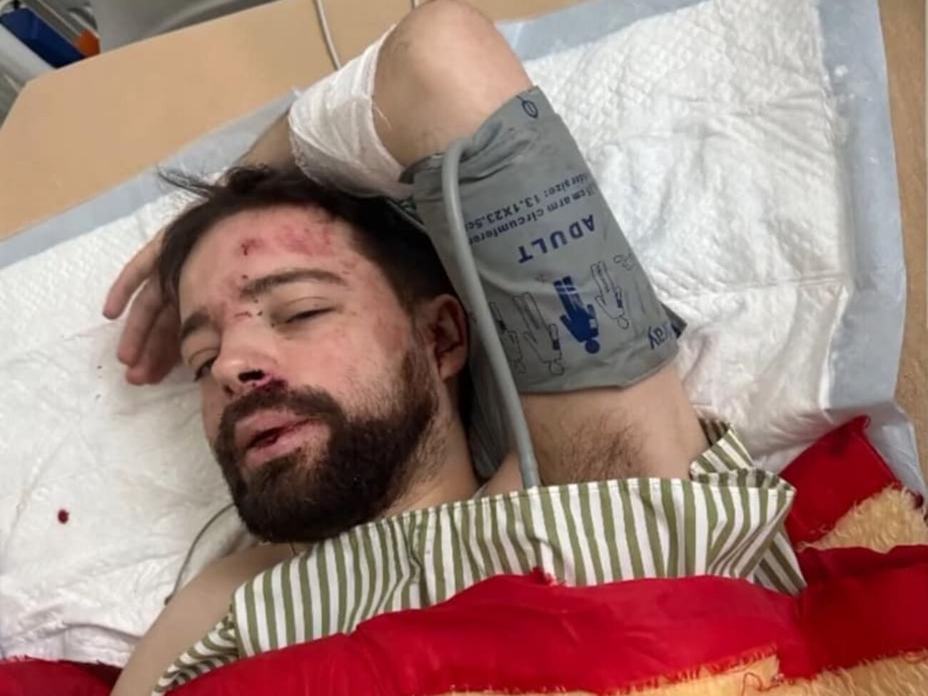 Чоловік опинився в лікарні після того, як утік у СЗЧ, розповіли військові