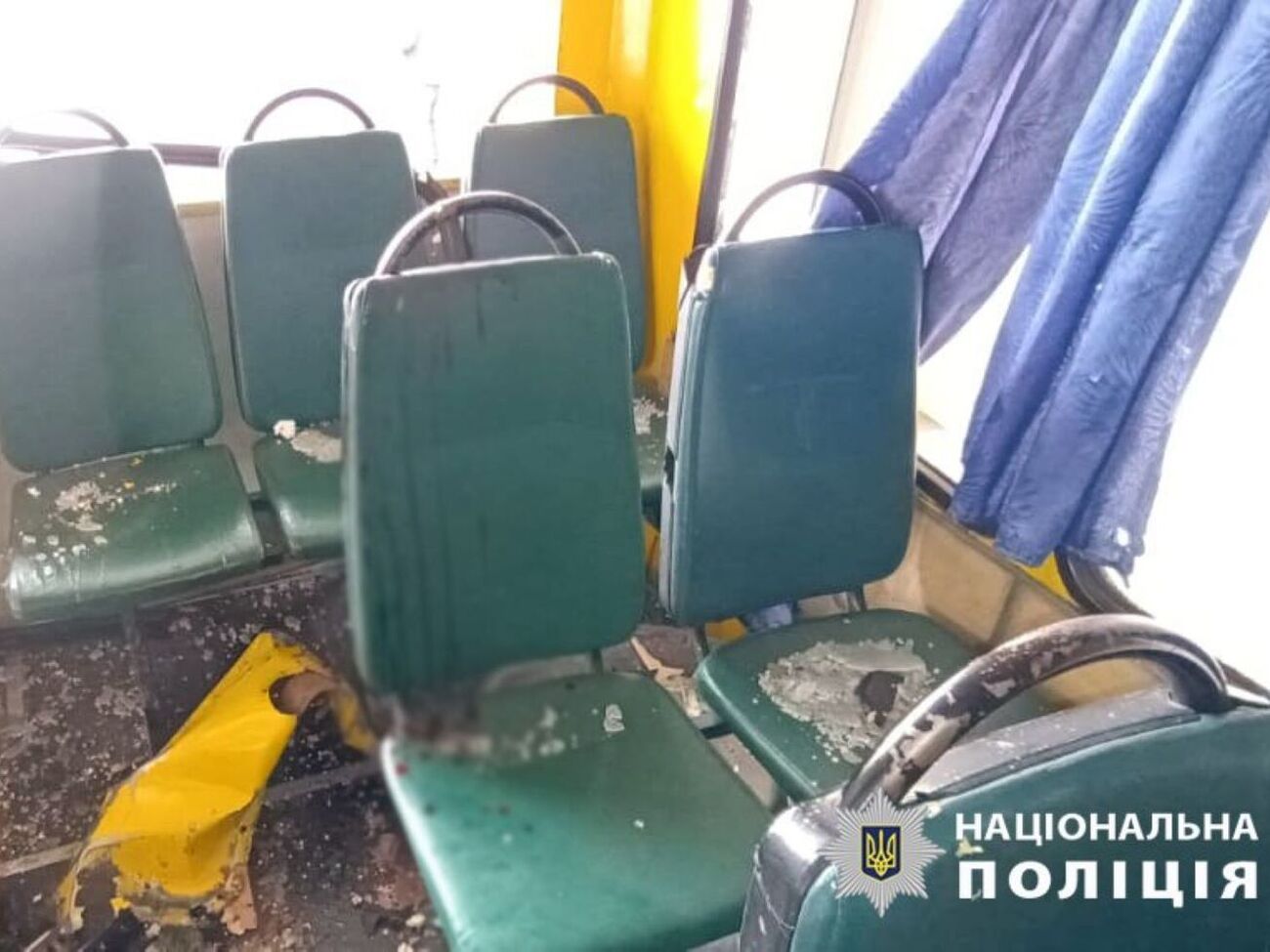 61-річна жінка померла в реанімації