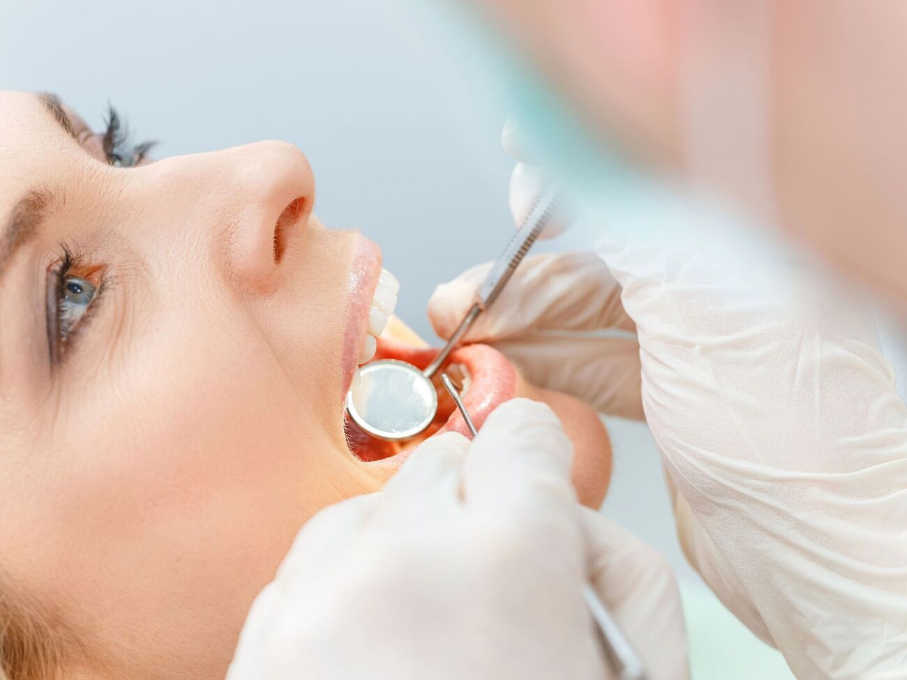 По словам стоматолога, идеальный вариант – почистить зубы перед едой, а после завтрака – просто прополоскать рот водой