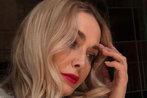 Сумская о родинке: Я решила ее удалить, потому что она уже не была признаком очаровательности. Она мешала