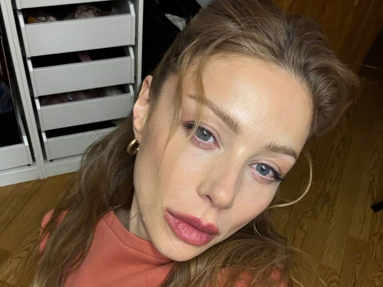 Тіна Кароль: Я не робила пластику. Не зверталася до таких процедур