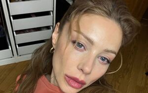 Тіна Кароль: Я не робила пластику. Не зверталася до таких процедур