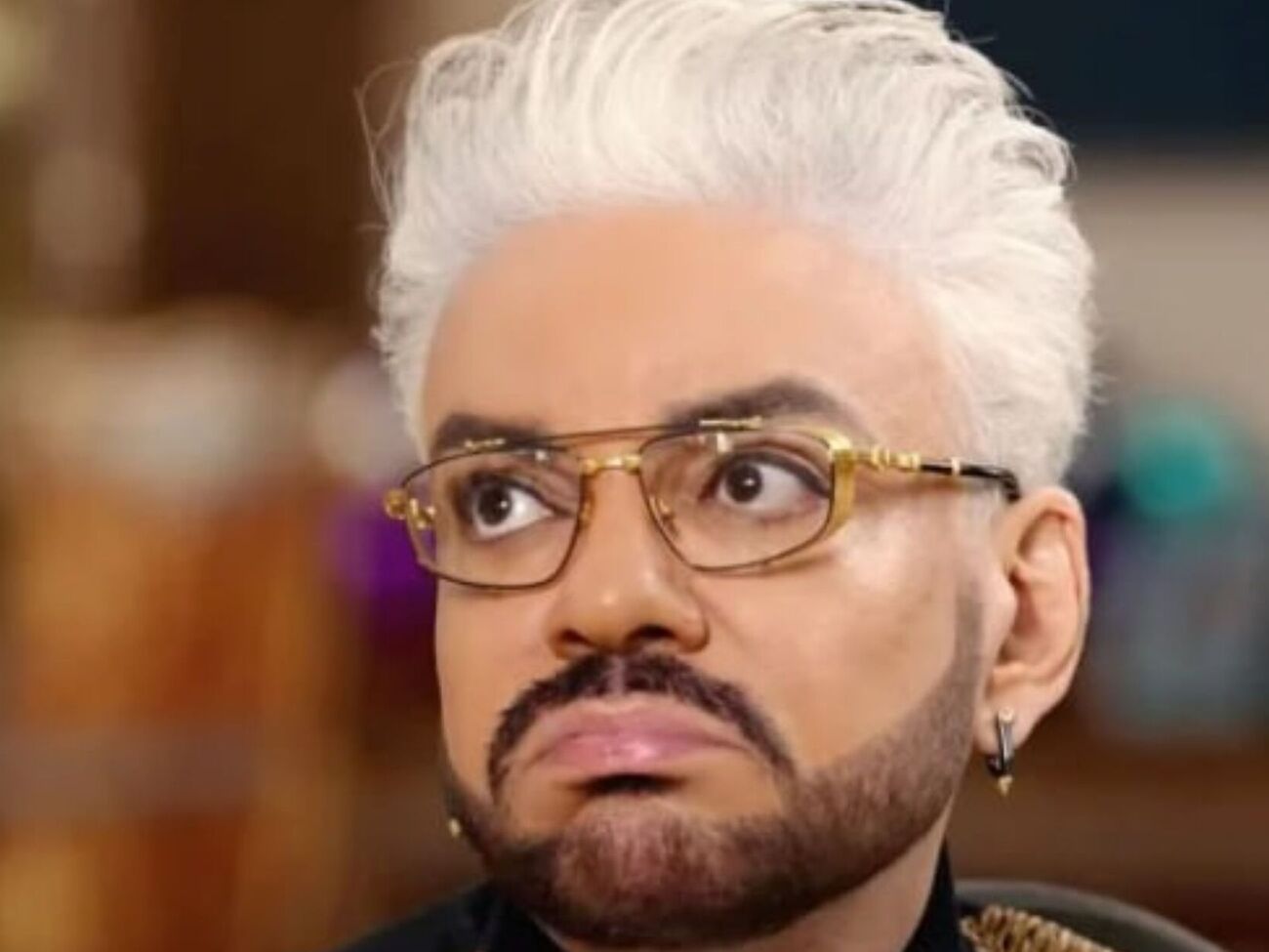 Киркоров получил ожоги и не может восстановиться