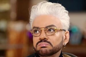 Киркоров получил ожоги и не может восстановиться