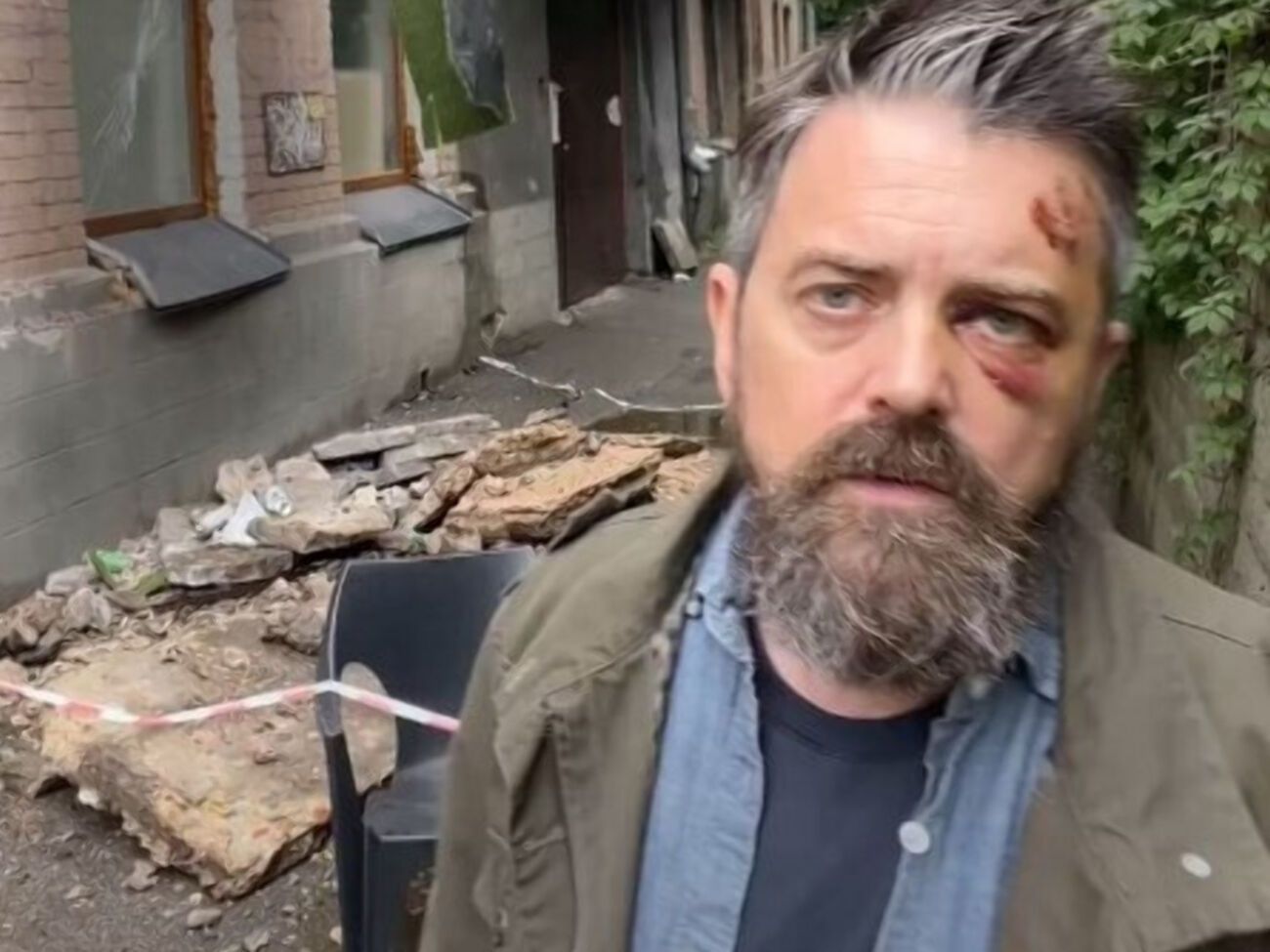 Гражданин США пострадал