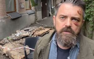 Гражданин США пострадал