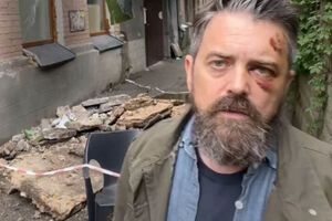 Гражданин США пострадал