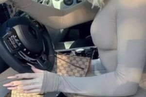 Из-за быстрой потери веса руки также стремительно худеют