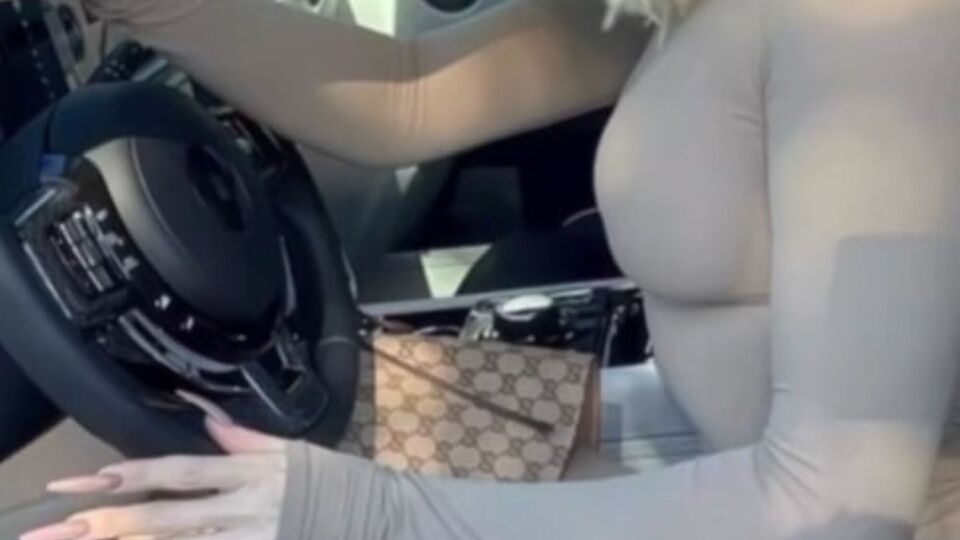 Из-за быстрой потери веса руки также стремительно худеют