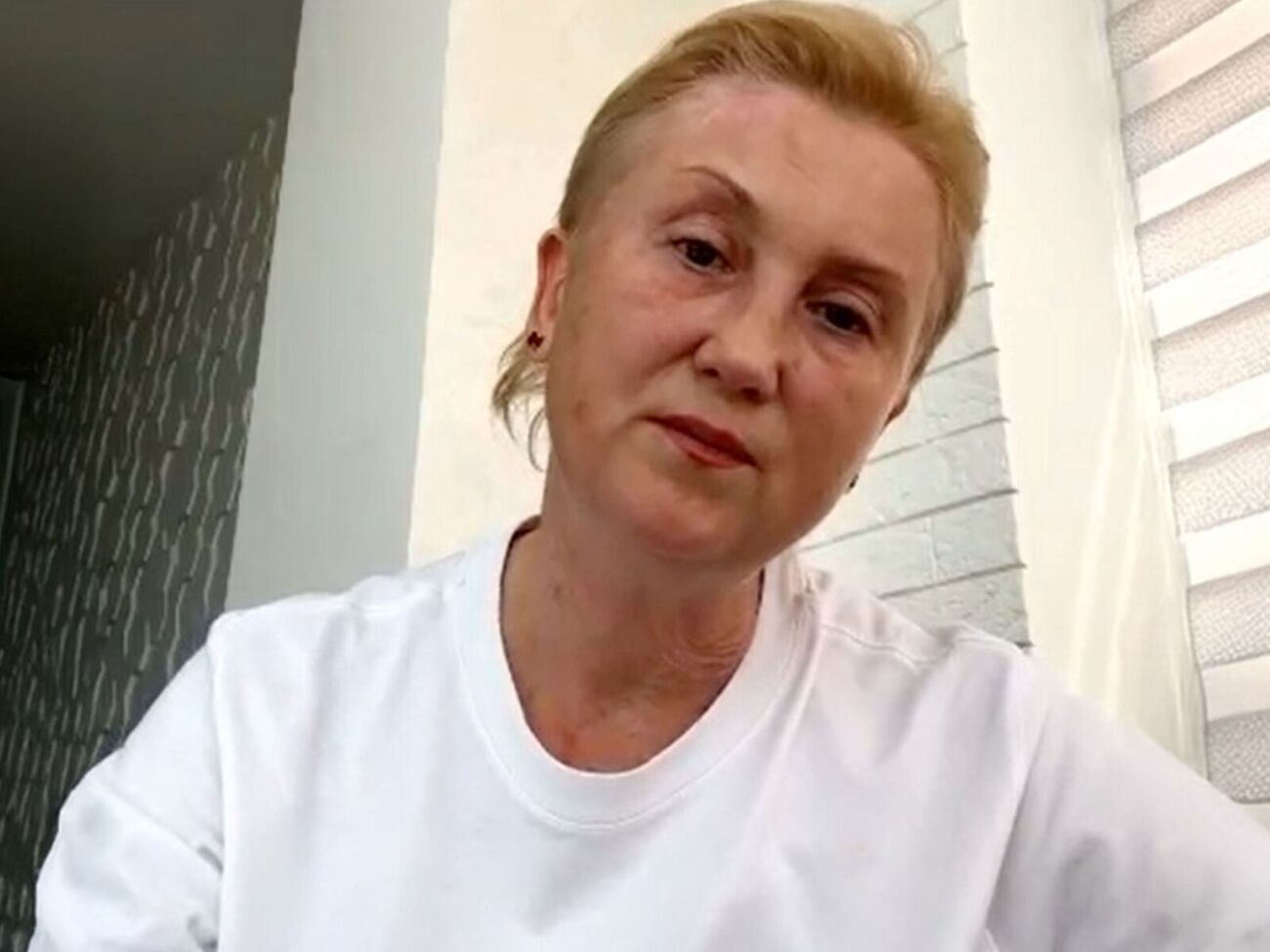 Вера: Мне сделали несколько операций, в том числе с трепанацией черепа и пересадкой кожи