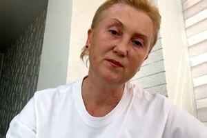 Вера: Мне сделали несколько операций, в том числе с трепанацией черепа и пересадкой кожи