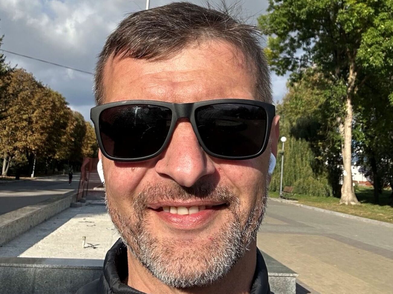 Дианов: Очень часто меня спрашивают о руке. Работает еще не очень хорошо