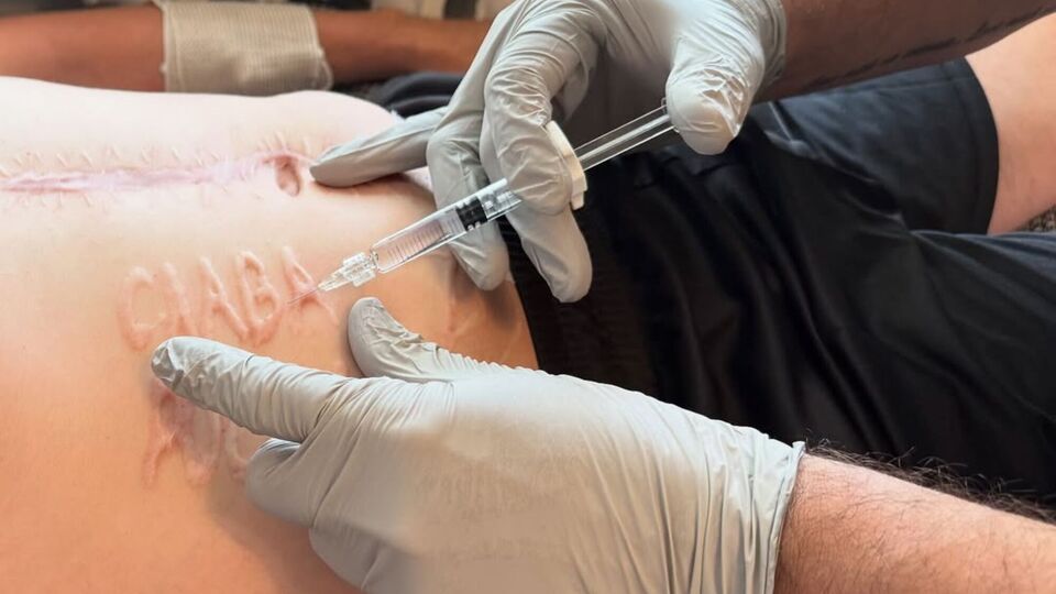 Зараз звільненому з російського полону військовому вводять ін'єкції полінуклеотиду