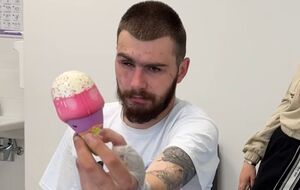 Військовому повернули здатність тримати предмети