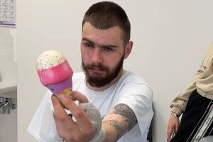 Військовому повернули здатність тримати предмети