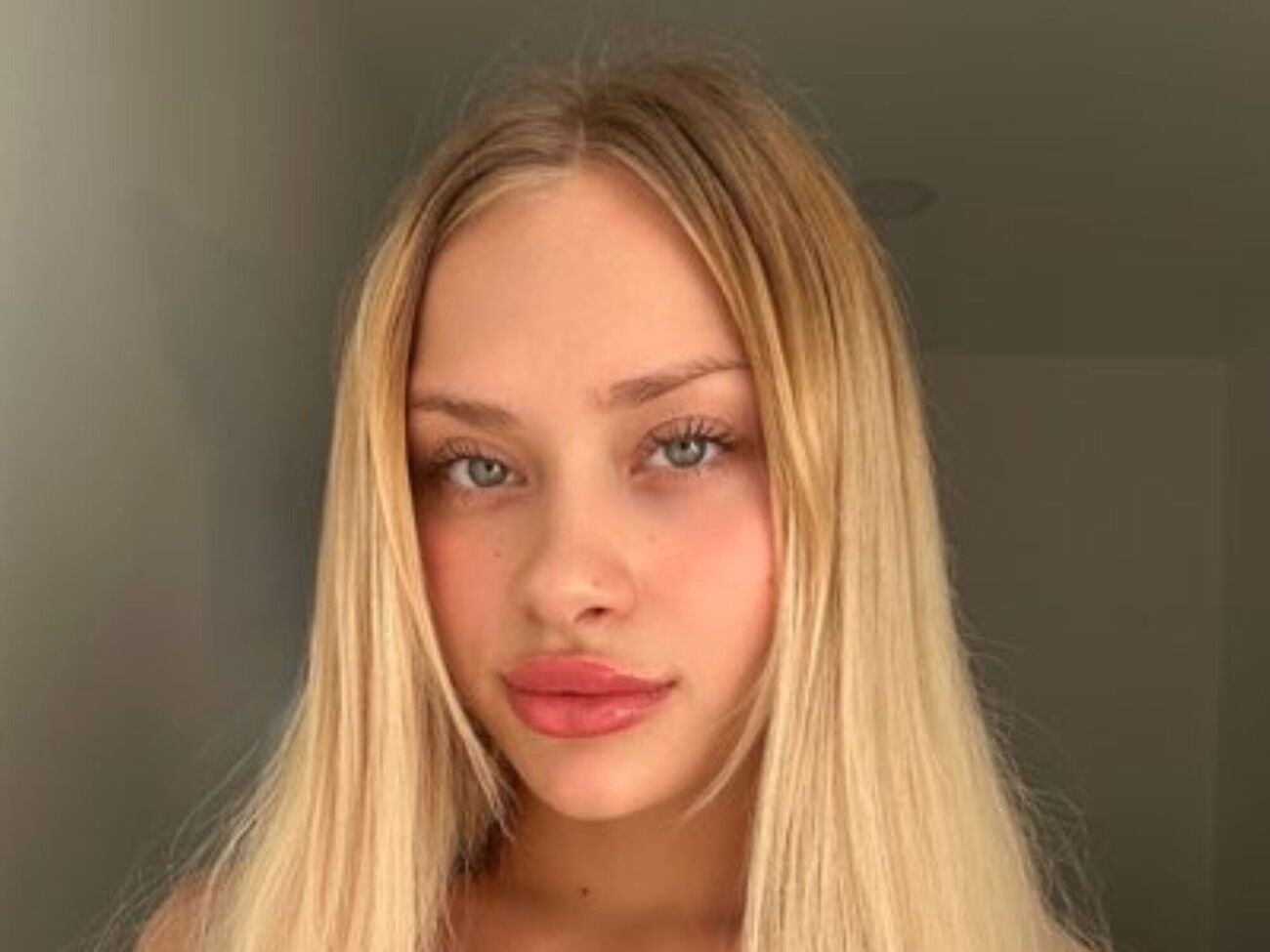 Ковальчук: Передвигаюсь в основном на коляске и использую костыли тоже