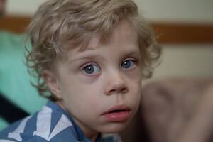 Хлопчик зможе чути навколишній світ