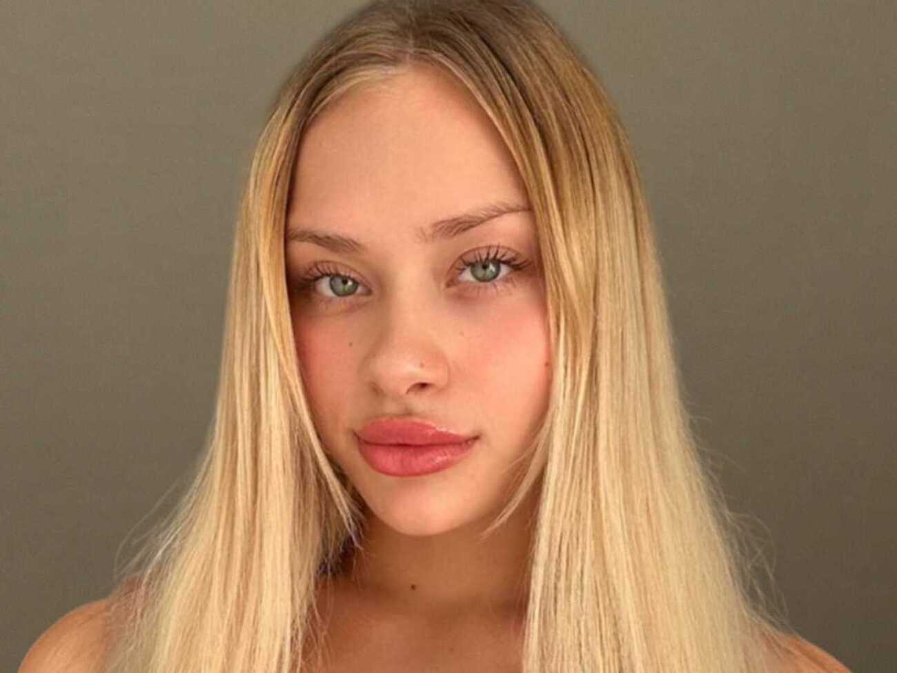 Ковальчук зазнала серйозних травм