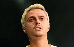 Alekseev заплатил за свои виниры $10 тыс.