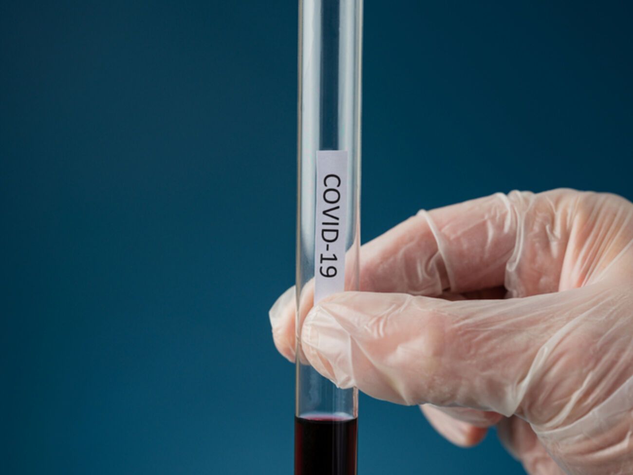 Новый штамм демонстрирует повышенную способность к распространению, заявили в ЦОЗ