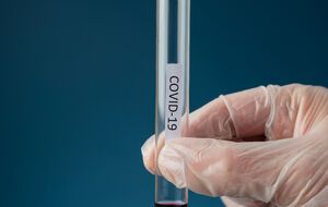 Новый штамм демонстрирует повышенную способность к распространению, заявили в ЦОЗ