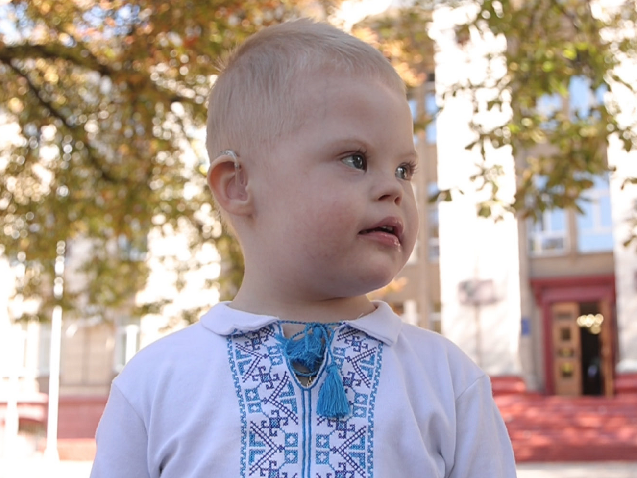 Зі слуховими апаратами фахівці прогнозують для Богдана покращення мовлення