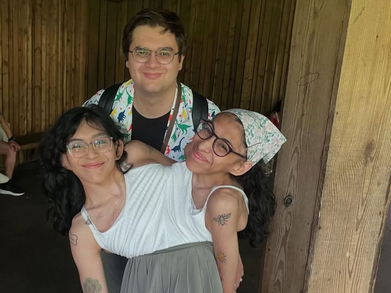 У сестер Андраде спільні ребра, кровоносна, травна й репродуктивна системи, але у кожного своє серце, легені й шлунок